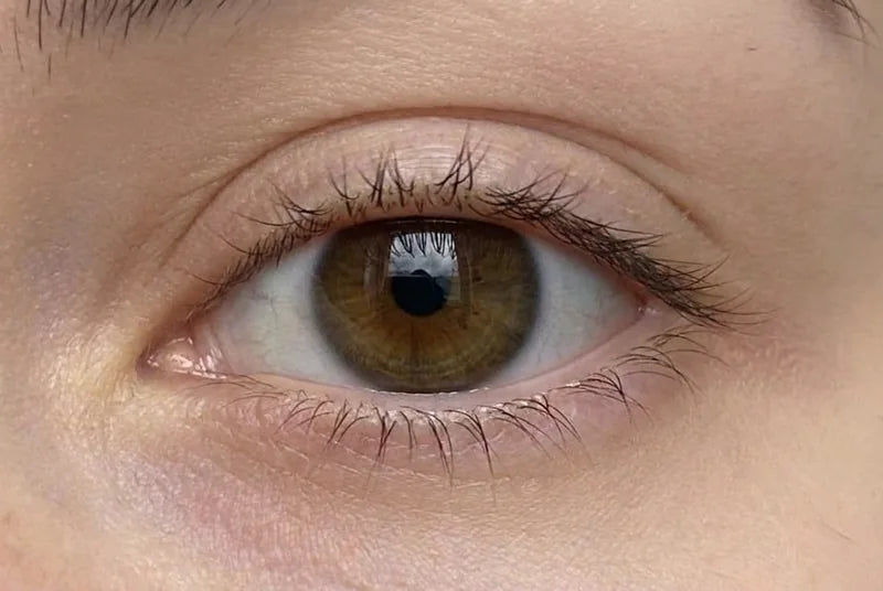 Antes
